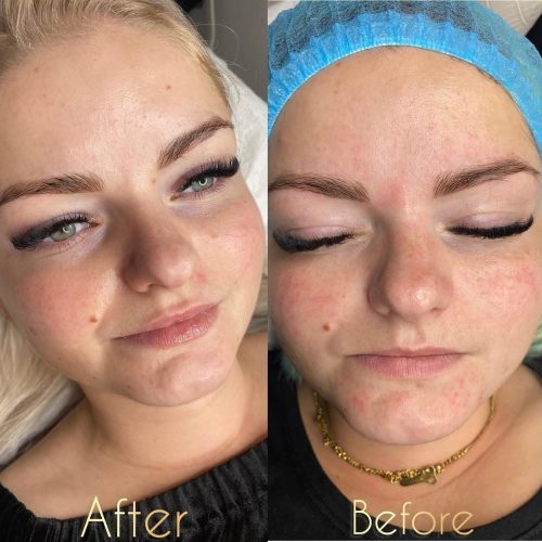 Skóra - iluzaesthetic (1)