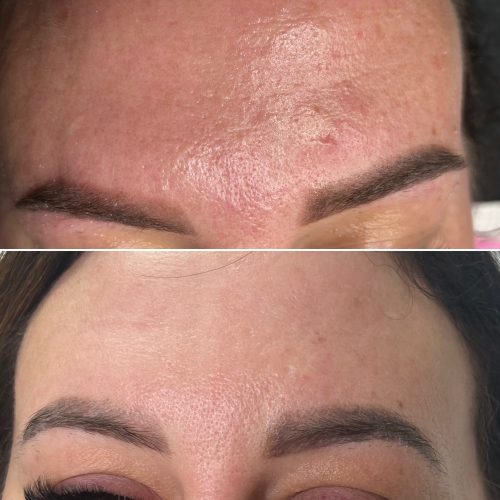 Skóra - iluzaesthetic (12)