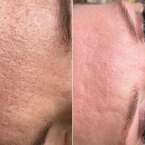 Skóra - iluzaesthetic (16)