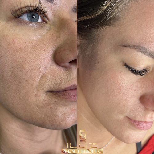 Skóra - iluzaesthetic (5)